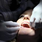 Mocne zęby na długo: jak wygląda zabieg wszczepiania implantów zębowych?