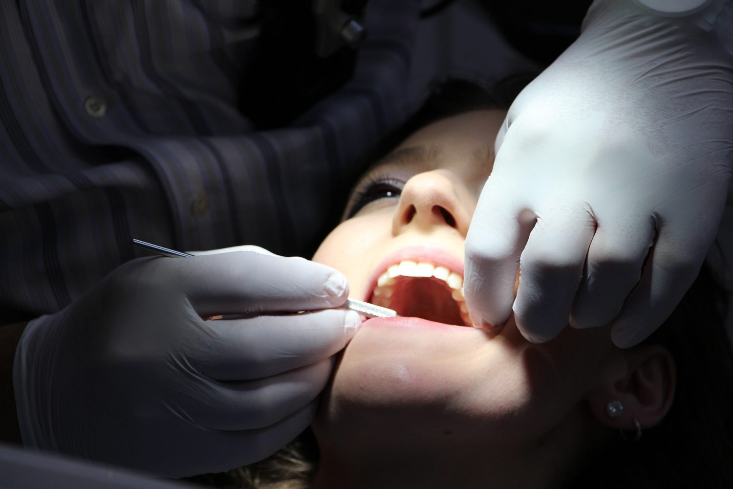 Mocne zęby na długo: jak wygląda zabieg wszczepiania implantów zębowych?